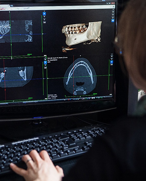 Dental team member looking at scan of patient’s jaw